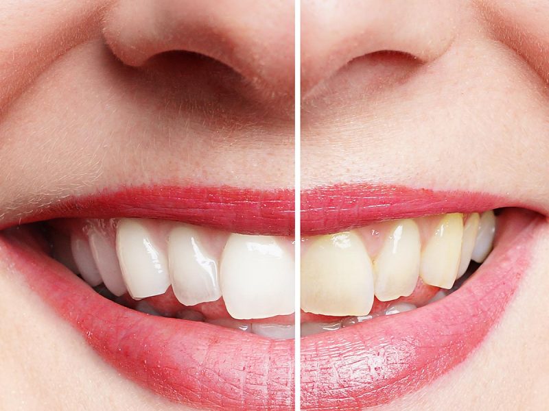 Praxis-Dr-Hertan-Aesthetische-Zahnheilkunde3